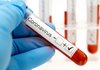Єврокомісія схвалила використання препарату Ремдесивір для лікування коронавірусу